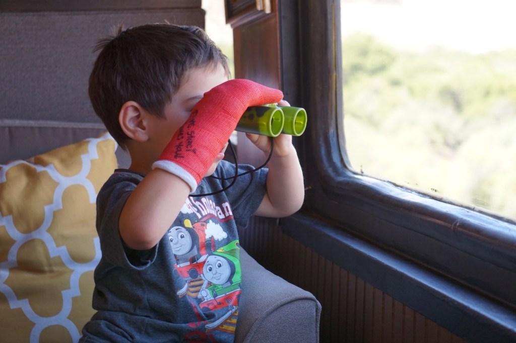 Going on vacation and your child is injured? A train ride is perfect for all family members.